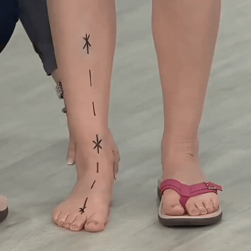 Kerry® | Orthopedic Summer Sandals
