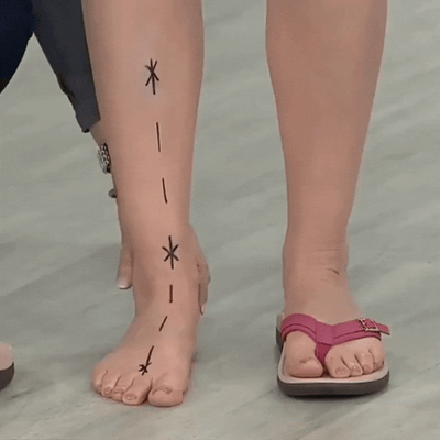 Kerry® | Orthopedic Summer Sandals